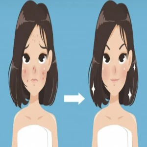 7 Foods That Reduce Acne And Acne Scars